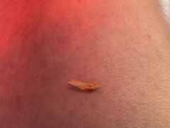 -新甲连锁灰指甲·甲沟炎·鸡眼(黑龙江路店)