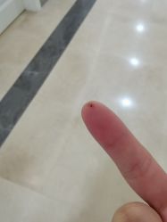 -伊丽莎白医疗美容