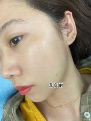 点击看大图 -小忠丽格医美