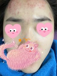 体验后-天津伊美尔医疗整形美容专科医院