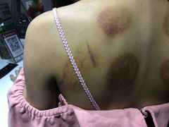 -SPA·印象足道养生(大运河度假区四望亭店)