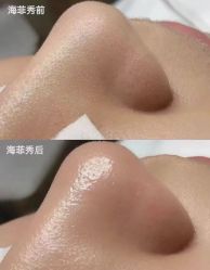 点击看大图 -栖SPA·ONDA ·海菲秀·皑皑科技美肤中心