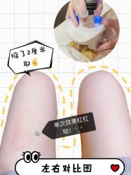 -Lily纤美·科技减脂中心