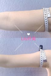 -Lily纤美·科技减脂中心