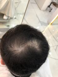 -发饰美男士增发补发假发定制店