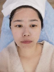 -小忠丽格医美