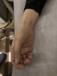 -肥三针腧穴瘦身馆