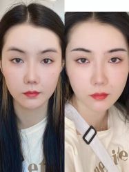 -Doris多里斯半永久纹眉·SMP纹发·发际线