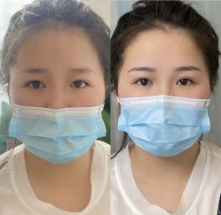 点击看大图 -Doris多里斯半永久纹眉·SMP纹发·发际线