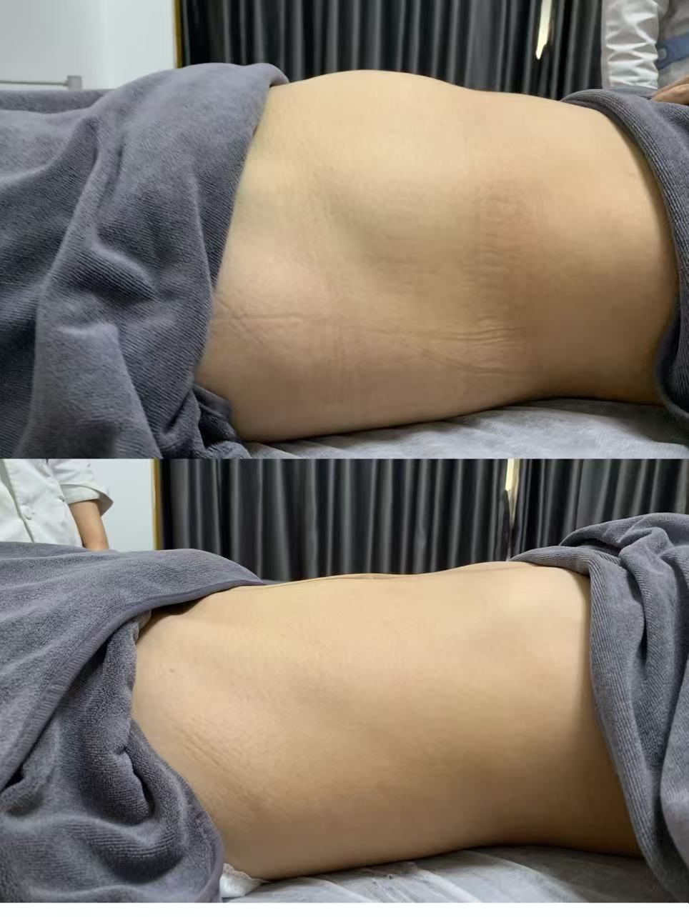 脏腑下垂,大肚子来涵美如初