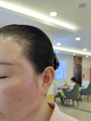 -长沙雅美医疗美容医院