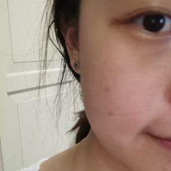 体验前-北京米扬丽格医疗美容·联合丽格鼻整形中心