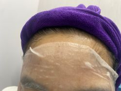 -广州美莱医疗美容医院