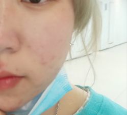 -禾壹净·素颜美问题肌肤修护中心