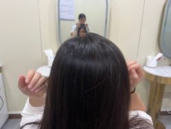 -碧莲盛·不剃发植发