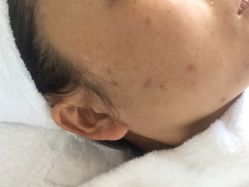 点击看大图 -痘博士北京·全国连锁祛痘机构