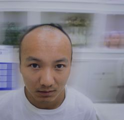 -大麦微针植发全国连锁