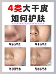 -克丽缇娜