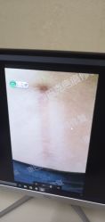 -康巴克疤痕修复连锁机构