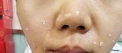 -北京美痣堂古方祛痣斑疣瘊