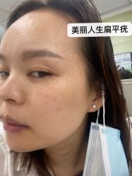 -爱莎扁平疣·汗管瘤·斑痣中心