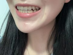 -极光口腔·矫正种植修复(锦江店)