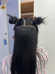 -碧莲盛不剃发植发