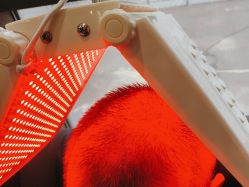 -碧莲盛·不剃发植发