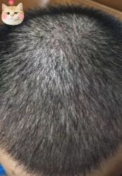 -大麦微针植发丨全国连锁