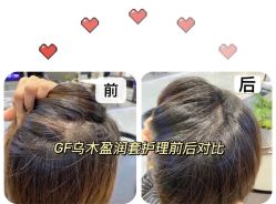 -希梵尔头皮抗衰·科技养发