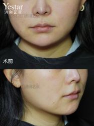 -Yestar艺星整形美容医院