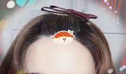 -大麦微针植发全国连锁