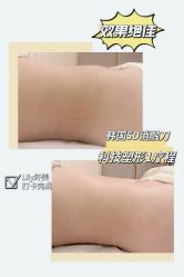 -Lily纤美·科技减脂中心