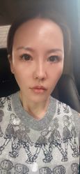体验后-鑫元辰医疗美容整形