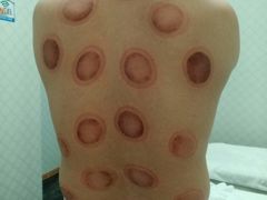 -1号足道推拿会馆