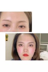 点击看大图 -Doris多里斯半永久纹眉·SMP纹发·发际线