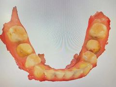 -同步齿科·数字化正畸种植口腔中心(珠海店)