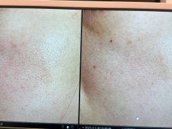 -苑苑vbeauty科技美容SPA