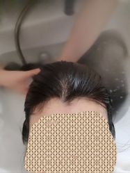-菩叶脱发白发中心