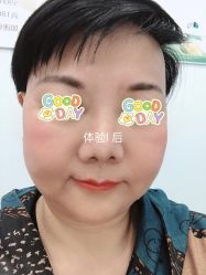 体验后-北京楚诺医疗美容
