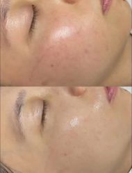 -SOS修丽可.痘肌修复中心