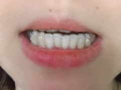 -深圳佑诺口腔门诊部