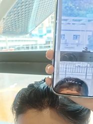 -碧莲盛·不剃发植发