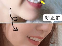 -极光口腔·矫正种植修复(锦江店)