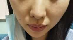 -北京美痣堂古方祛痣斑疣瘊
