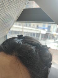 -碧莲盛·不剃发植发