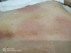 点击看大图 -苑苑vbeauty科技美容SPA