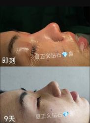-北京米扬丽格医疗美容·联合丽格鼻整形中心
