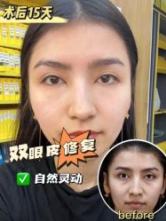 -上海伊莱美医疗美容医院