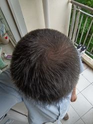 -雍禾植发全国连锁